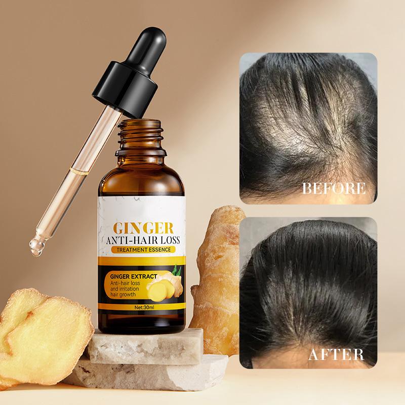 Ginger Hair Growth Serum | Promotes Hair Growth | Prevents Hair Loss | Haircare Comfort | Soothes Scalp Itching | Nourishes Dry Hair | Scalp Care | Natural Organic Ingredients | Hair Growth Essence | Unisex | Hair care oil