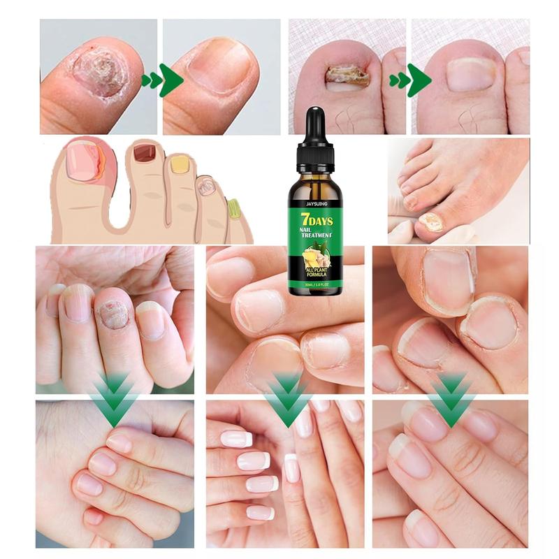 [ONLY $8.99] JAYSUING Ginger Nail Treatment Nail Support Nail Care Nail Polish Nail Art