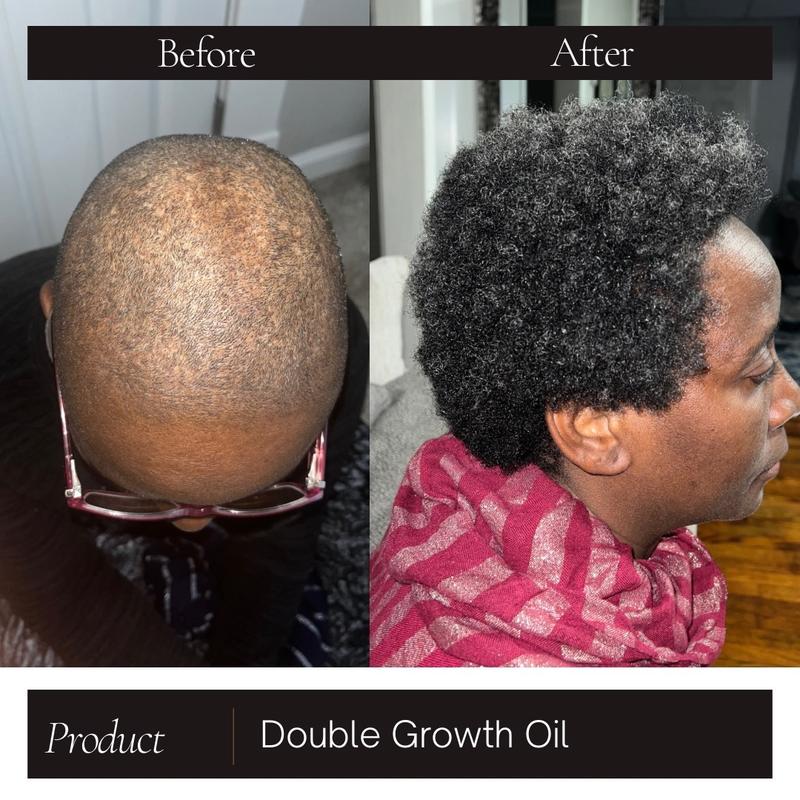 Hair Growth Oil- Double Growth Oil| Rosemary & Cayenne pepper Lightweight hair and scalp oil Haircare Peppermint Restore Comfort