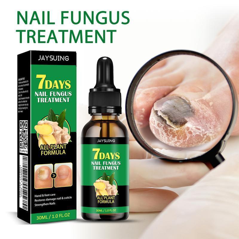 JAYSUING Ginger Nail Treatment Support Nail Care with Vitamin E and Plant Essential Oils- toes  nail paronychia beriberi Onychomycosis Nail deformation. Comfort Nail Polish Manicure Nail Art