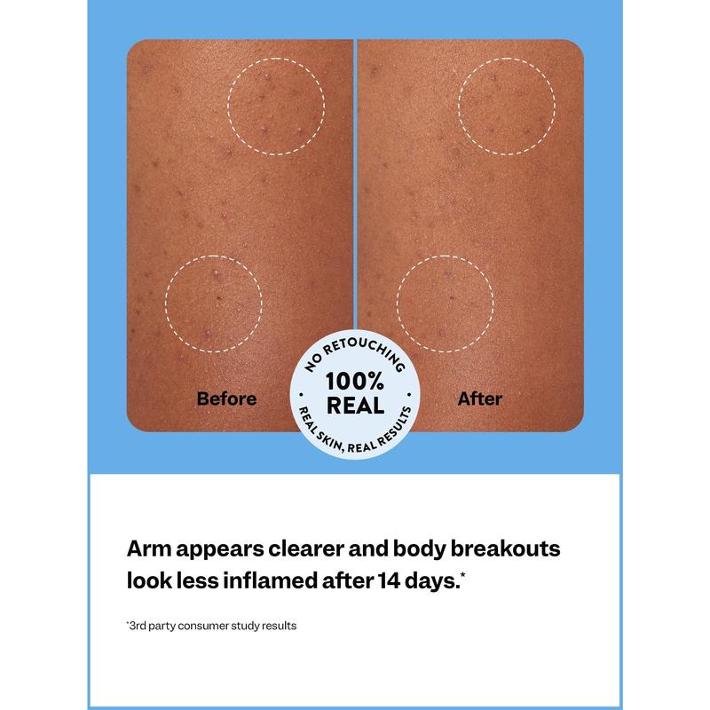 Body Breakout Patches