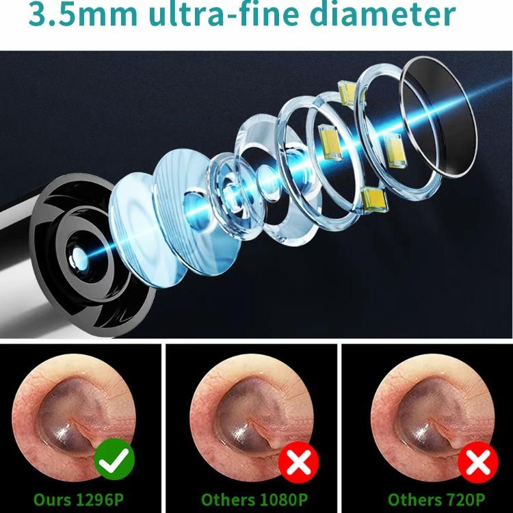 Ear Wax Removal Tool with 1080P Camera and Light - FSA HSA Eligible Ear Cleaner Kit, Includes 6 Spoons, Compatible with iOS & Android, Perfect for Safe and Precise Ear Cleaning (Black) Wireless Gentle