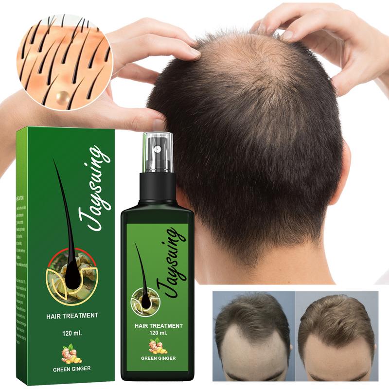 Jaysuing hair growth liquid strengthens hair, nourishes hair roots, grows thick scalp massage nutrient solution Hair growth essence spray, hair growth spray, nourishing ginger spray, hair growth spray, ginger spray Haircare Gentle Oil Plant