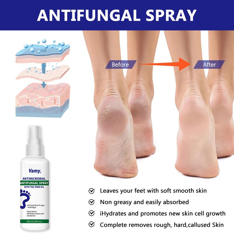 Vamyinfused foot sanitizer spray natural Tea Tree Oil Foot Care Spray and oregano leaf longacting disinfectant antibacterial spray Tinea pedis,itching House antibacterial protection ,itchy skin,foot support ,