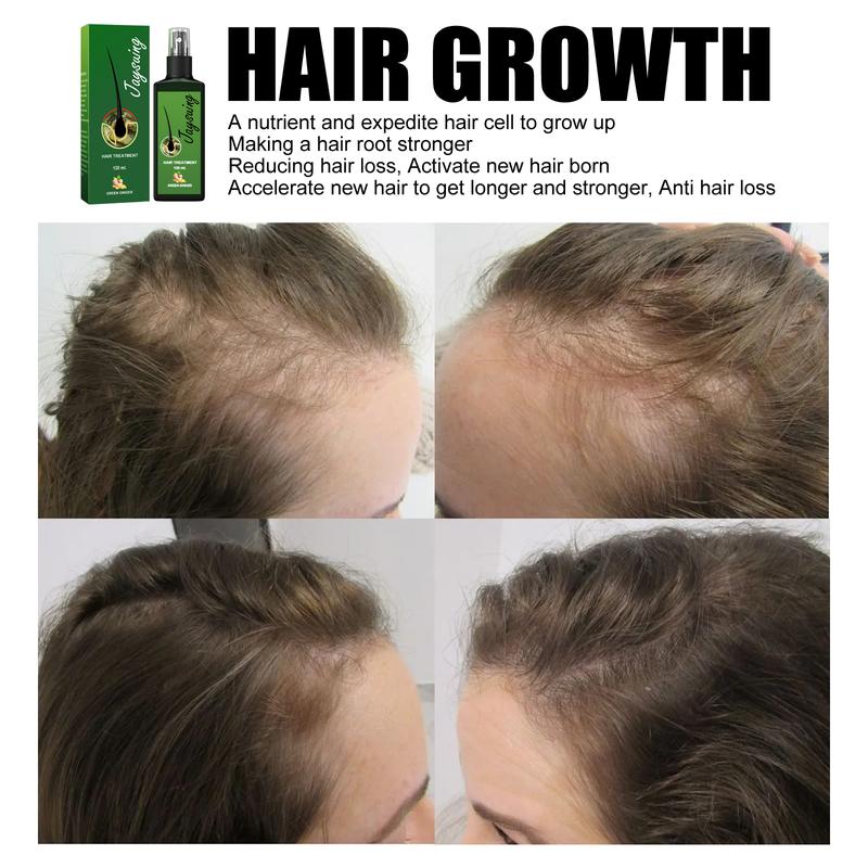 Jaysuing hair growth liquid strengthens hair, nourishes hair roots, grows thick scalp massage nutrient solution Hair growth essence spray, hair growth spray, nourishing ginger spray, hair growth spray, ginger spray Haircare Gentle Oil Plant