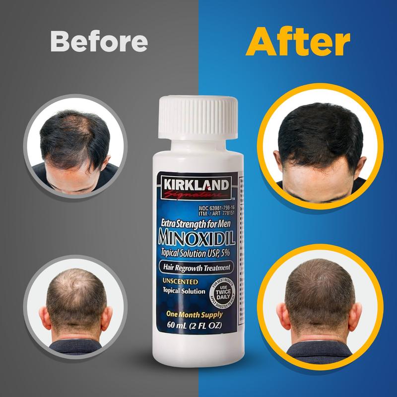 Kirkland Signature Minoxidil Liquid Extra Strength Hair Loss Regrowth Treatment for Men, 5% Topical Solution for Hair Growth with Premium Hair Brush