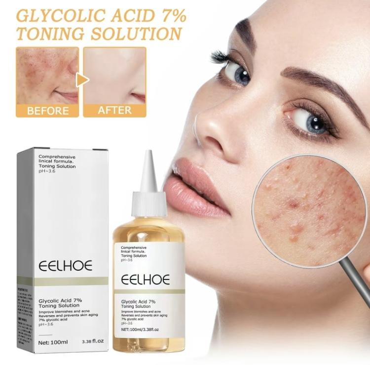 EELHOE Glycolic Acid 7% Exfoliating Toner - 100ml Skin Repair, Exfoliate, Wrinkle Exfoliating for Face, Hydrates  Skincare Smoother Aloe Delicate Facial Sensitive Gentle Gift Mom Radiant Comfort tone brightening