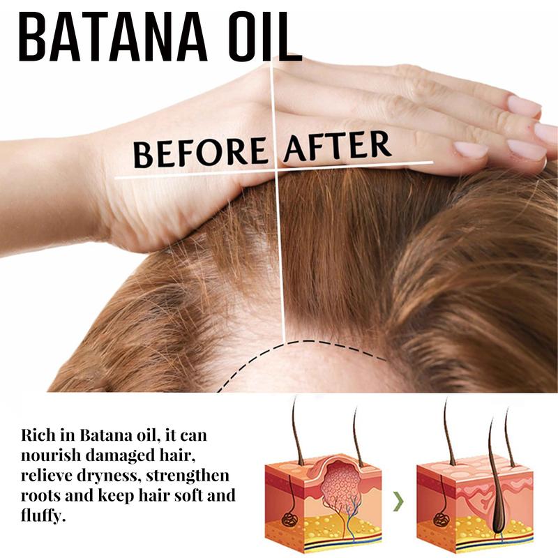 Batana Oil Dense hair spray,Hair Growth Oli,moisturizing strengthens hair,Nourishing and Smoothing Hair Spray