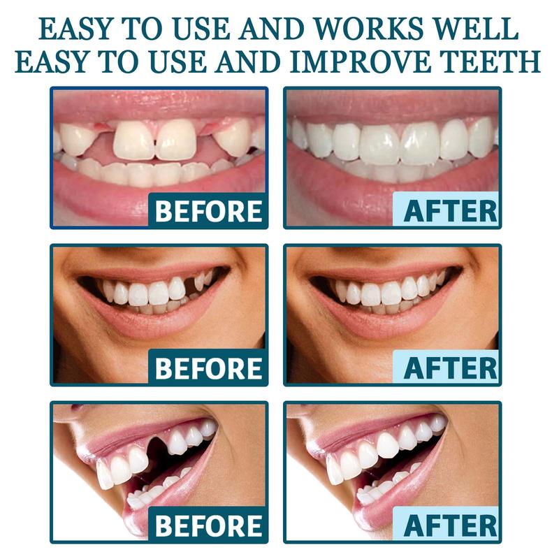 Temporary Teeth Perfect Cover,Adjustable Snap On,Moldable False Teeth for Beautiful Smile,Nature and Comfortable