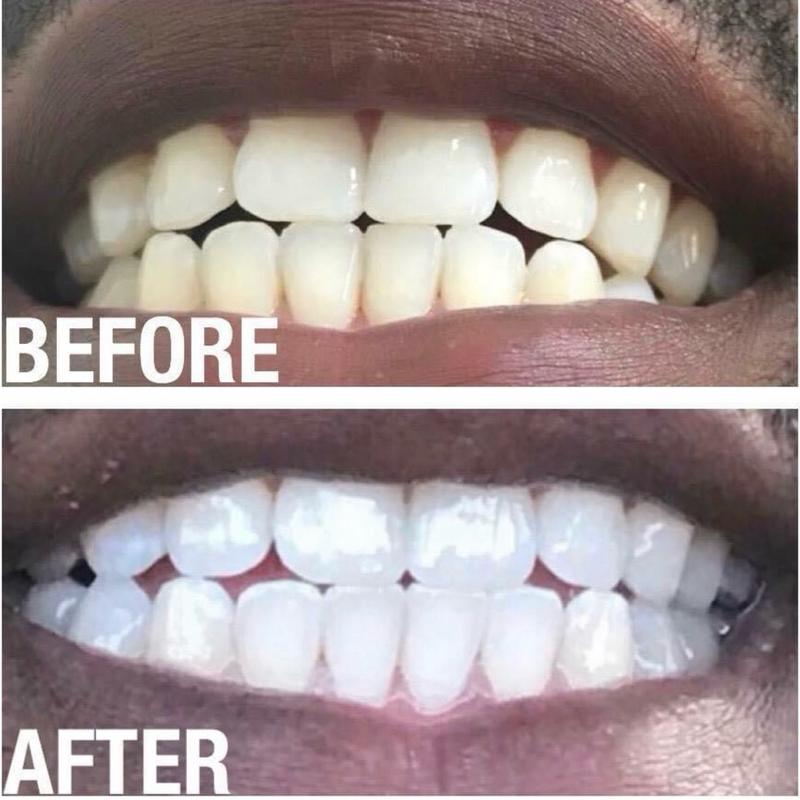 Nuskin Ap 24 Whitening Toothpaste - Fluoride and Fluoride Free - Oral Care