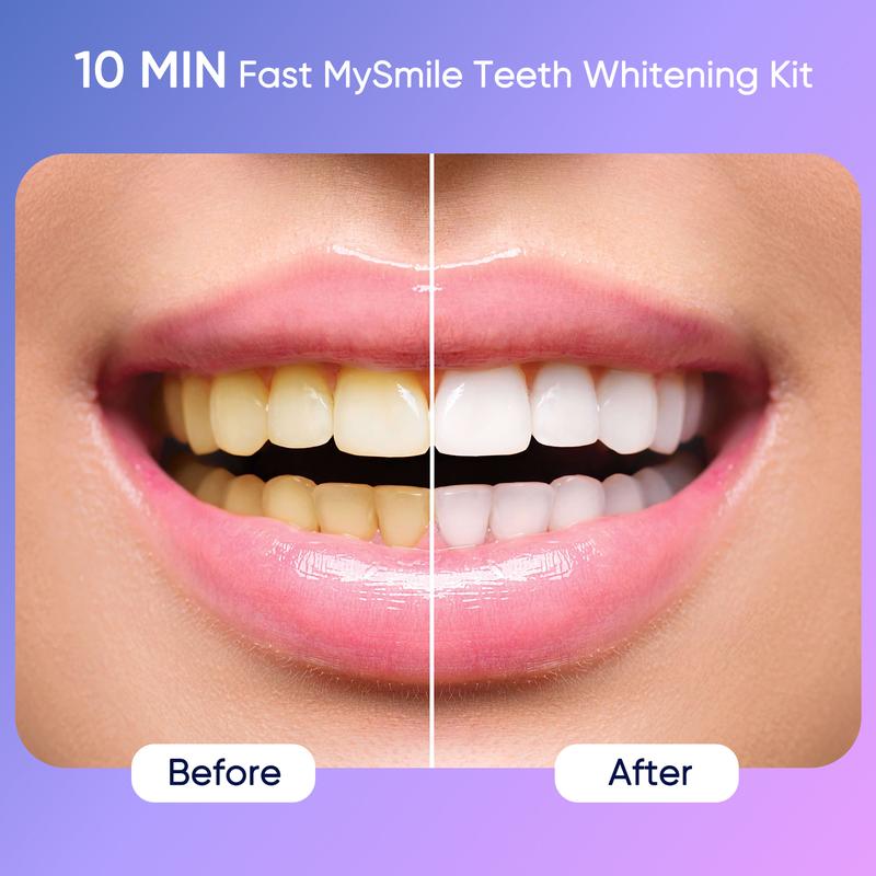 MySmile Ultimate Deluxe 10 Min Teeth Whitening Kit with 28 LED Light, 35% Carbamide Peroxide Teeth Whitening Gel, Helps Remove Years of Stains from Coffee, Soda, Wines, Smoking, Food (Result May Vary)