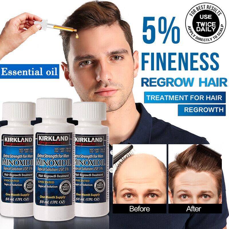 Kirkland Minoxidil 5% Men Hair Regrowth 3 Months Supply Extra Strength Hair Care Comfort Dropper