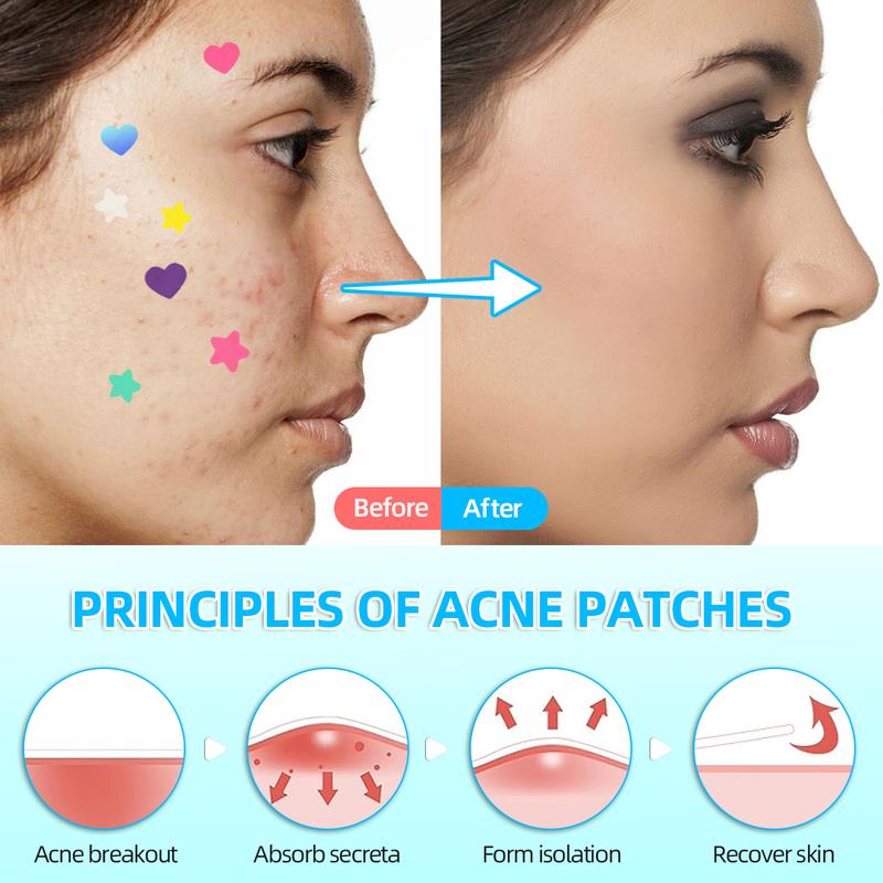 Star acne patch.hydrocolloid Acne patch, Tea Tree Oil,Witch Hazel Extract & Centella Asiatica Extract, 2 sizes Star Patch (240pcs) and Love Patch (216pcs) Skin Repair