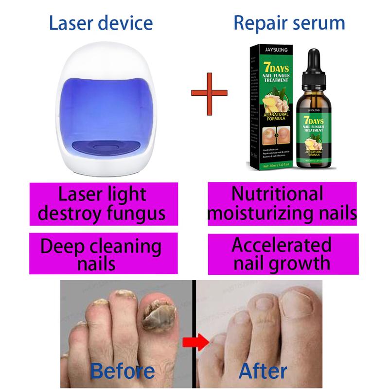 Nail Fungal Treatment Essential Oil Nail Fungus Removal Serum Foot Toe Onychomycosis Repair