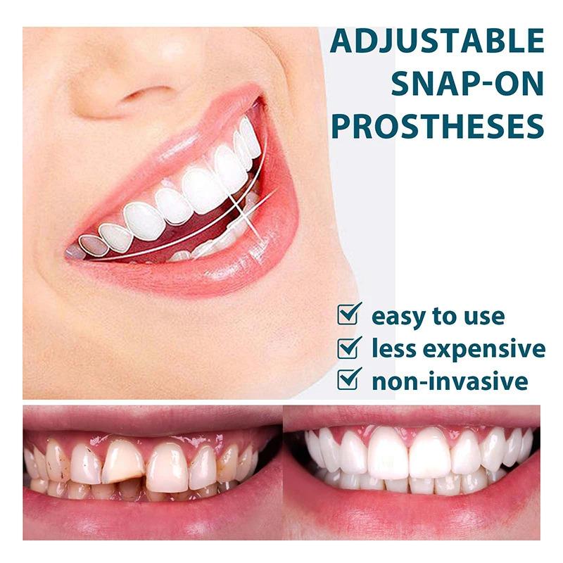 Adjustable Snap On Perfect Smile Dental Hygiene Upper Lower Fake Teeth Cover Veneers Dentures Braces Products Mold