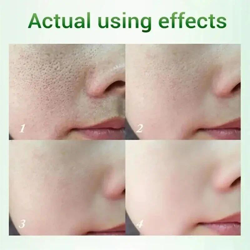 Salicylic Acid Pore Shrinking Cream Moisturizing Tighten Face Smooth Skin Care Product