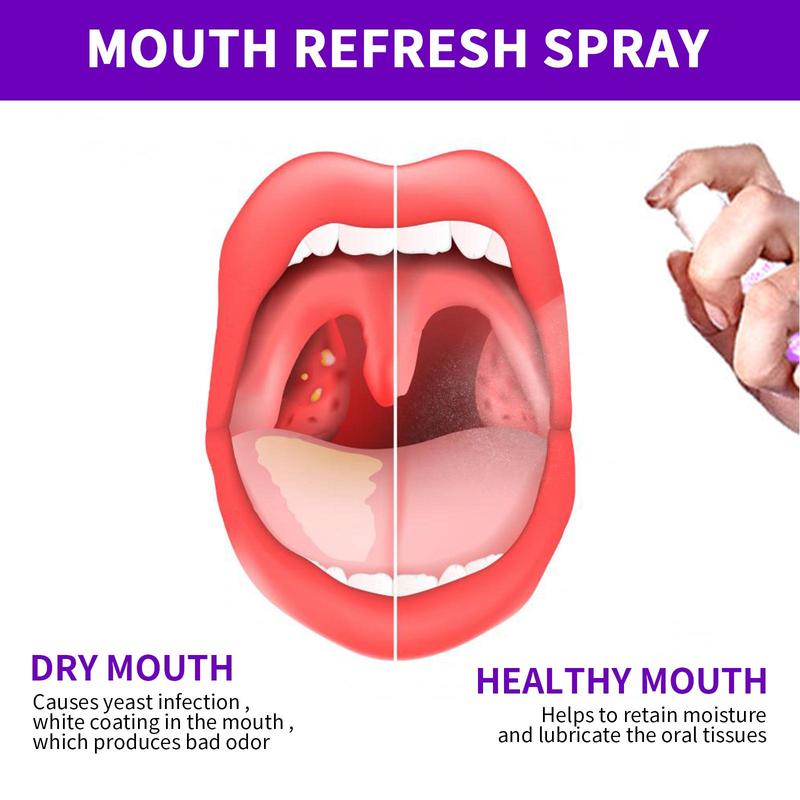 Fresh Mouth Spray cleans the mouth, freshens the odor, Protect oral health,leaves the breath fragrant, and is a portable spray Oral Cleanser