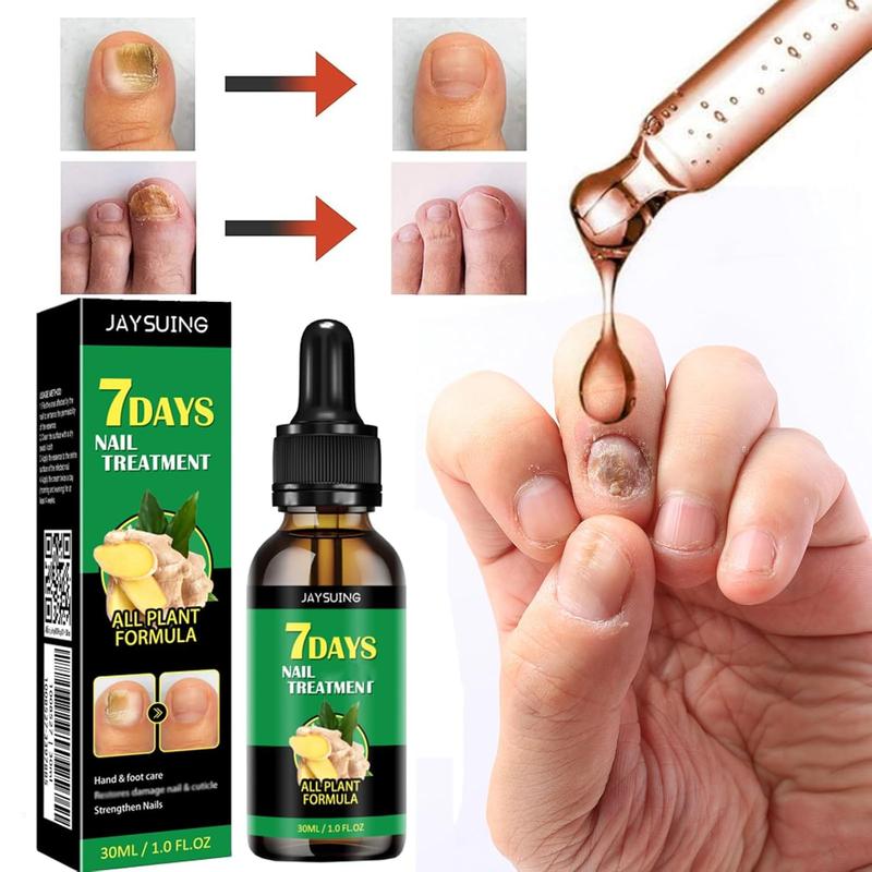 7days Nail Fungus Treatment, Ginger Nail Treatment, Multi-Purpose Nail Repair, Nail Nutrient Oil Strengthener Oil Serum Ginger Nail Growth Oil