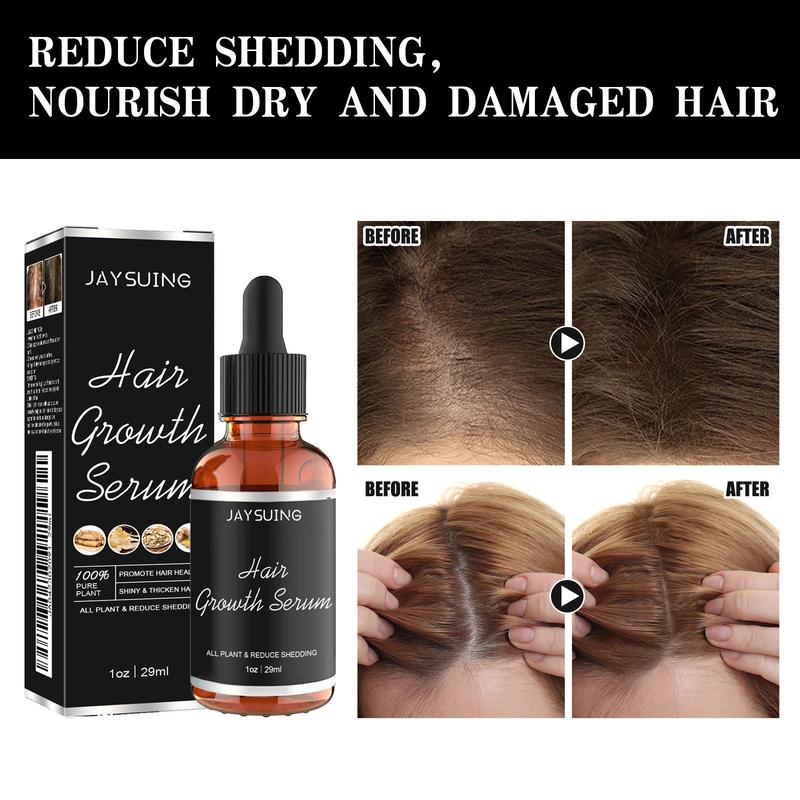 [Free shipping]Hair Growth Serum Oil Biotin Hair Regrowth Treatment for Scalp Hair Loss Hair Thinning for Men Women