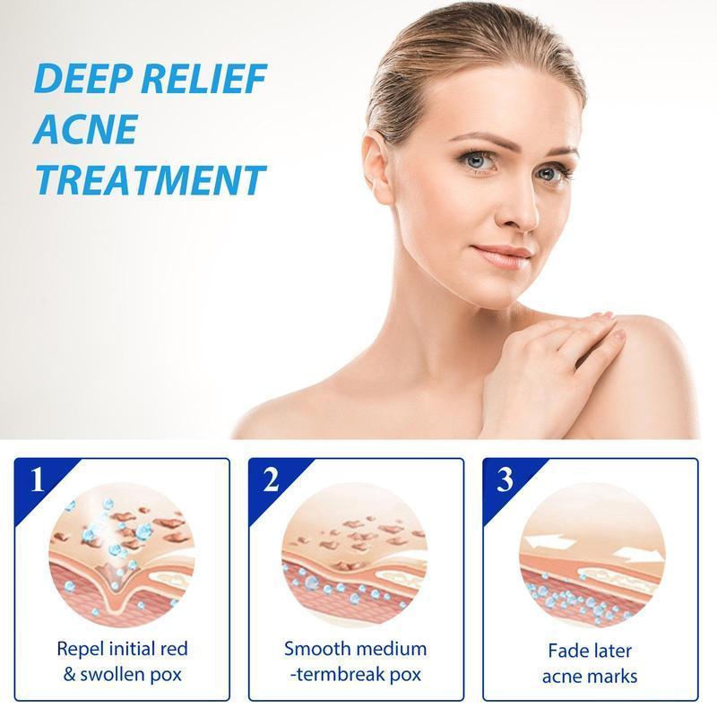 Murad ACNE CONTROL Deep Relief Acne Treatment with Salicylic Acid 2% - Skin Repair - Skincare Cleanser Cherry