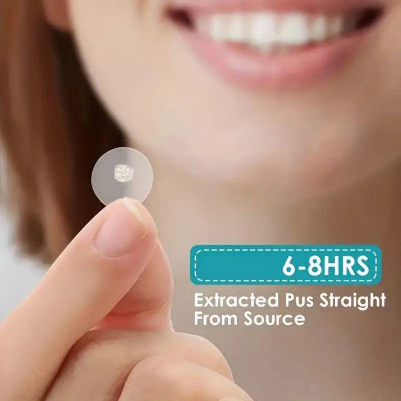 Pimple Patch, 1080pcs box Invisible Acne Cover Patches, Hydrocolloid Acne Patches, Skin Care Products for Women & Men, Christmas Gift