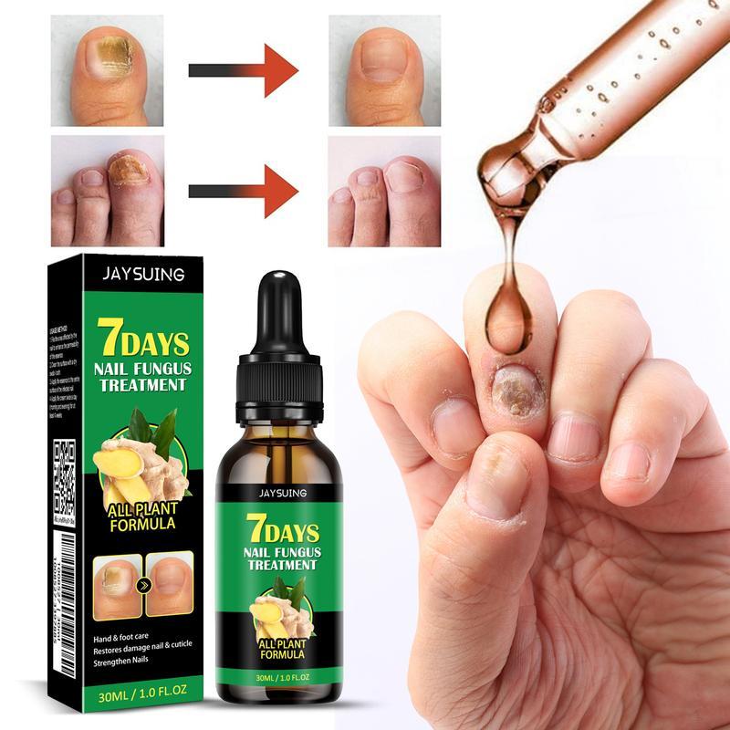 JAYSUING 7 days Nail Treatment Ginger Nail Serum, Ginger Cuticle Care Oil for Nails, Cuticle Serum for Nails, Ginger Nail Treatment Nail Support Nail Care