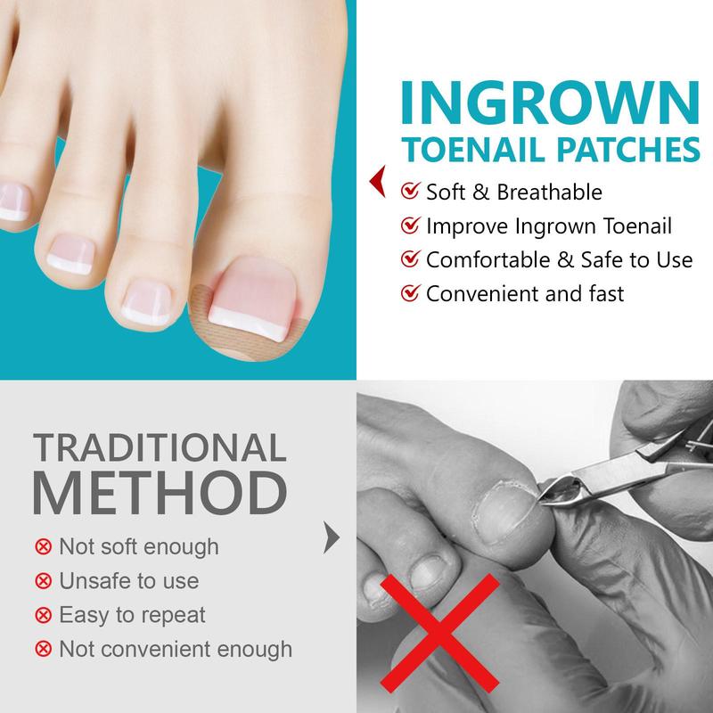 Ingrown Toenail Patches, 120pcs Corrective Patches with 2 Counts Manicure Tools, Convenient and Quick To Improve Ingrown Toenails