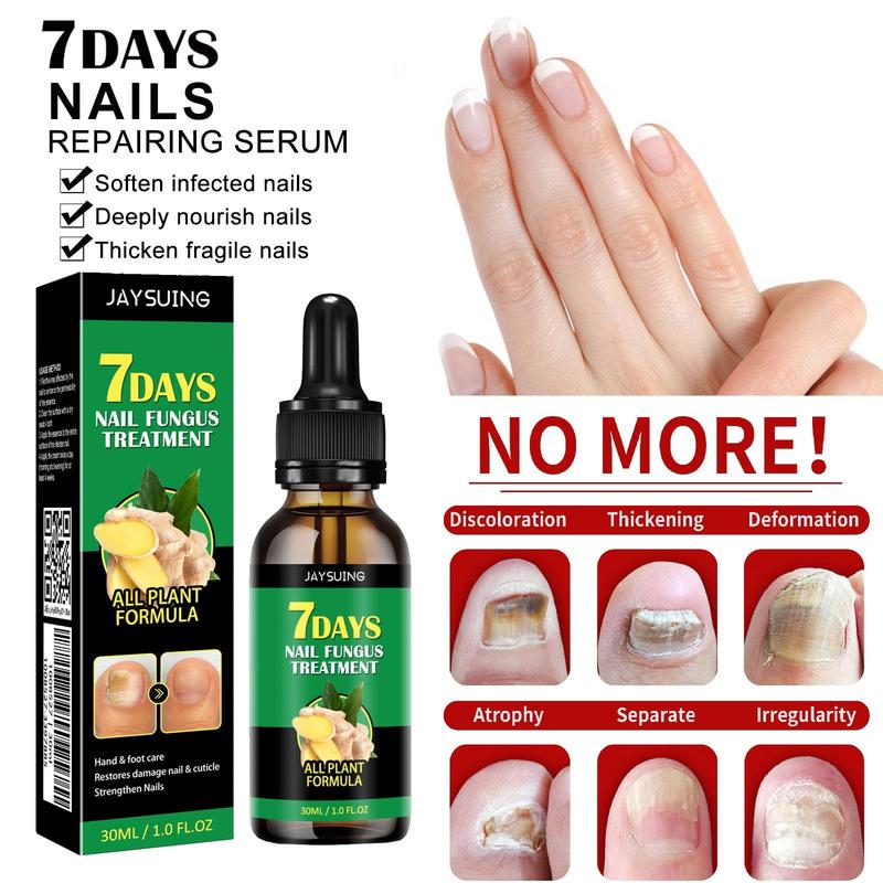 [Today $5.98] JAYSUING Ginger Nail Treatment Nail Support Nail Care