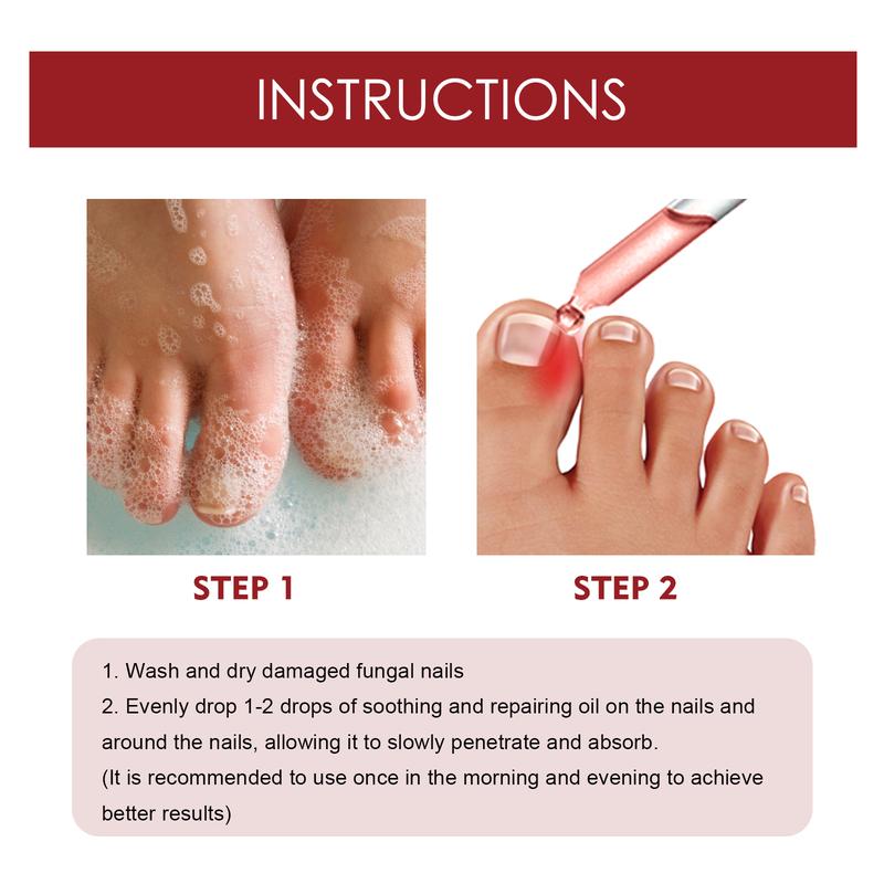 Natural Anti Paronychia Relief Oil, Ingrown Toenail Removal, Correction Treatment Oil for Damaged & Discoloration Nail