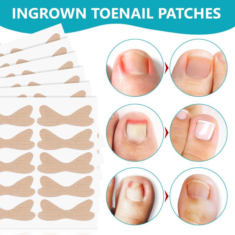 Ingrown Toenail Patches, 120pcs Corrective Patches with 2 Counts Manicure Tools, Convenient and Quick To Improve Ingrown Toenails