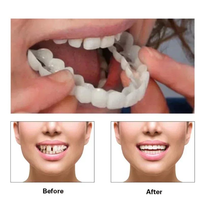 Heallor Dentures Full Set Natural Perfect Fit Teeth Snap On Silicone Denture Instant Smile Veneers Teeth Dentadura Bea