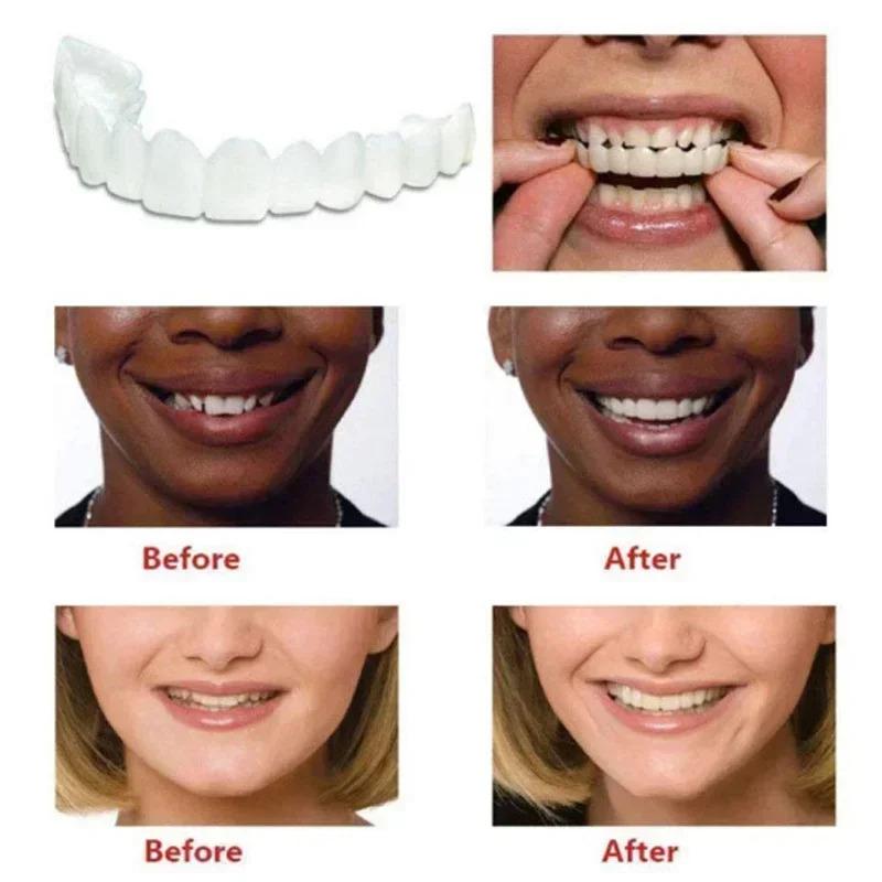 Heallor Dentures Full Set Natural Perfect Fit Teeth Snap On Silicone Denture Instant Smile Veneers Teeth Dentadura Bea