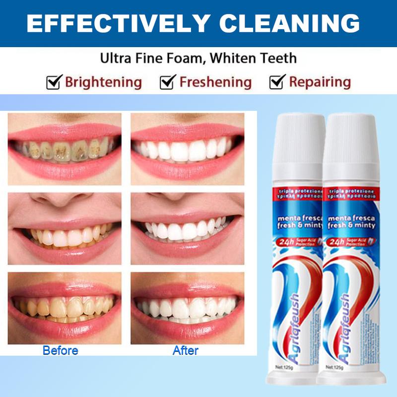 Whitening Probiotic Toothpaste, Press Directly Upright Toothpaste, Multi-effect Whitening Of Teeth, Prevention And Treatment Of Tooth Decay, Enhanced Formula Balances The Oral Microbiome, Removes Stains,  Provides  Fresh Breath toothpaste