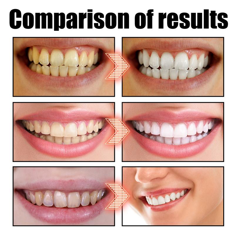 Pulling Oil Oral Rinse, To Tartar Very Well Beautiful Teeth And Fresh Breath Clean Oral Care Gums