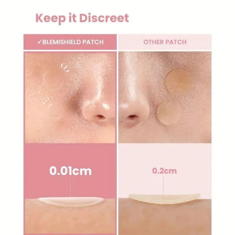 Round Shaped Acne Patch, 360pcs box Invisible Hydrocolloid Acne Covering Sticker, Facial Skin Care Product for Women & Men