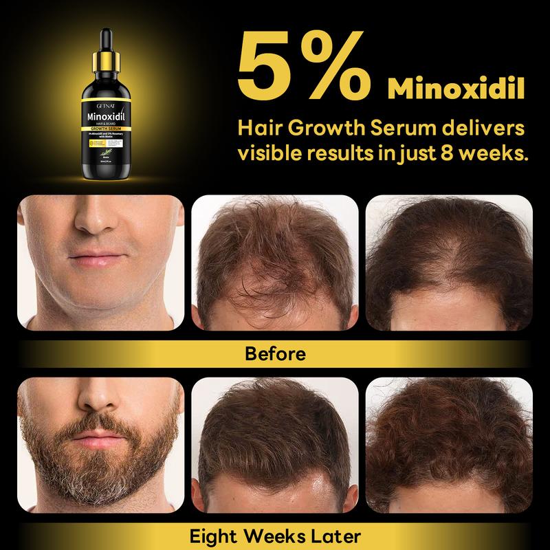 GFTNAT 5% Minoxidil Hair Serum for man and women with Tool