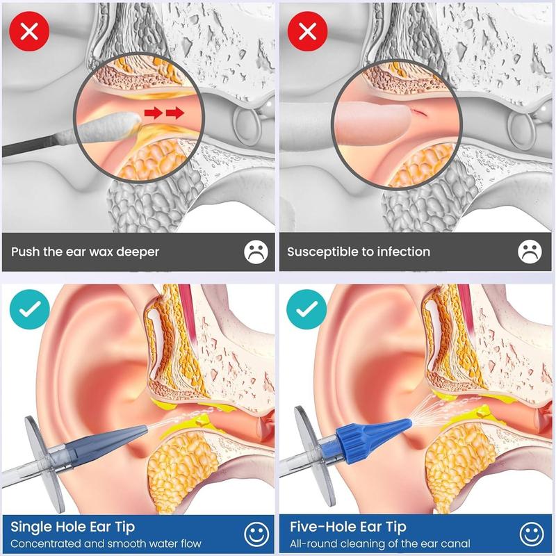 Manual Ear Wax Removal Kit, 1 Set Ear Wax Cleaning Tool, Ear Cleansing Kit, Safe and Effective Earwax Removal Tool for Women & Men