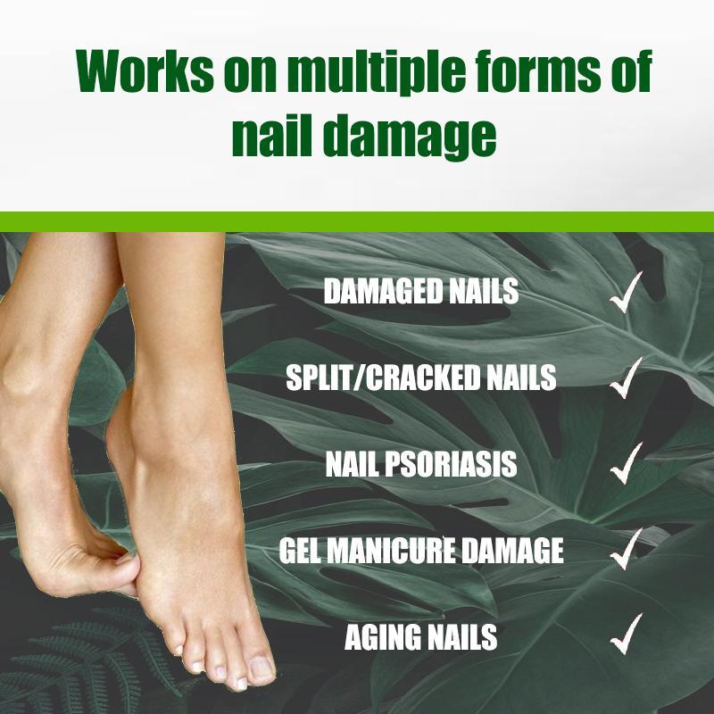 Tea Tree Oil Nail Treatment Nail Support Nail Care, Enriched with tea tree oil, enhance nail health, ensure comfort, and support nail art.South Moon Nail Care Moisturizer Nail  support with  Plant Drops Christmas Gift. Manicure Nail Polish nails