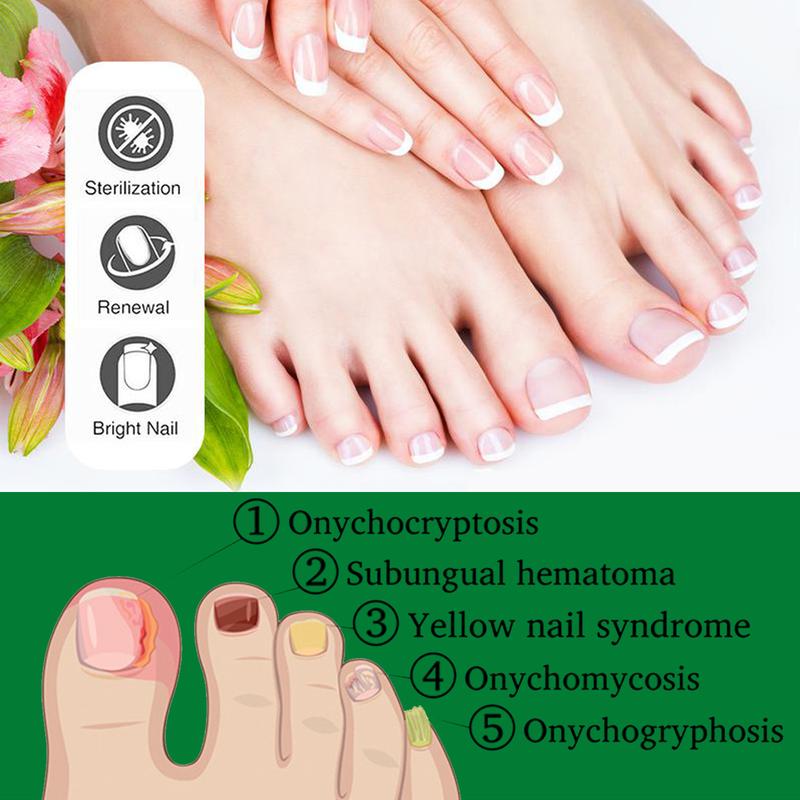 Ginger Nail Treatment Nail Support Nail Care