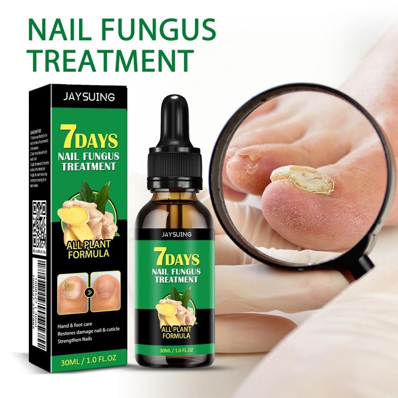 Ginger Nail Treatment Nail Support Nail Care