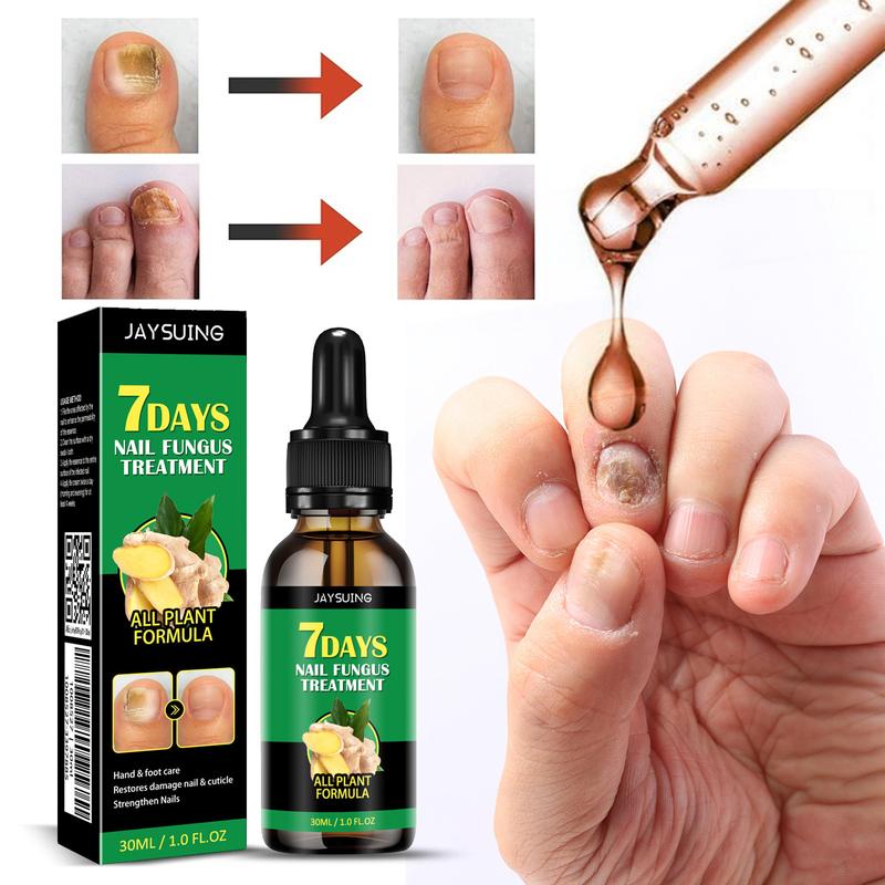 Ginger Nail Treatment Nail Support Nail Care