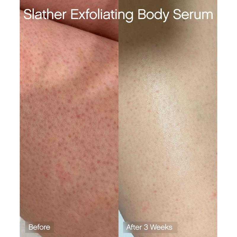 Slather Exfoliating Body Serum with Retinol, Lactic Acid, and Urea Body Care Smooth