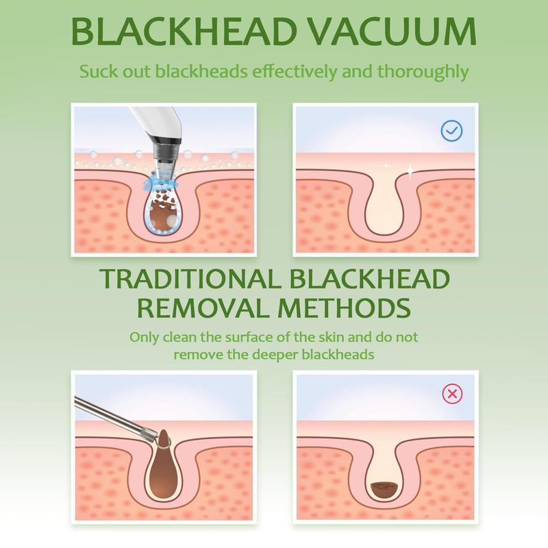 Blackhead Remover Vacuum - Black Head Remover for Face,Blackhead Extractor Tool with 3 Adjustable Suction Levels,4 Probes,USB Interface Type Pore Vacuum,Suitable for Women and Men (White) powerful suction glass rose bottle christmas 2024 ornament