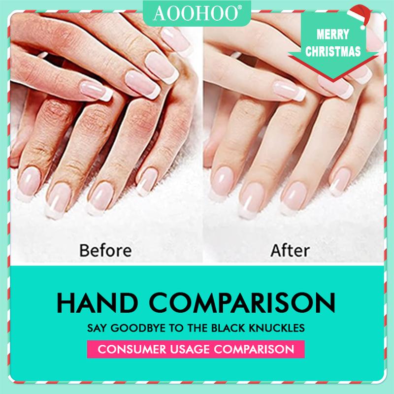 42% Urea AOOHOO Cream Moisturize & Exfoliate Cream 5.29 0z(150g) Foot&Hand Cream for Dry Cracked Heels, Feet, Knees, Elbows, Hands, Corn&Dead Skin&Cuticle Callus Remover, Toenail Softener, Keratolytic Skin Barrier Repair Cream,Calloused Feet&Athletes Foot