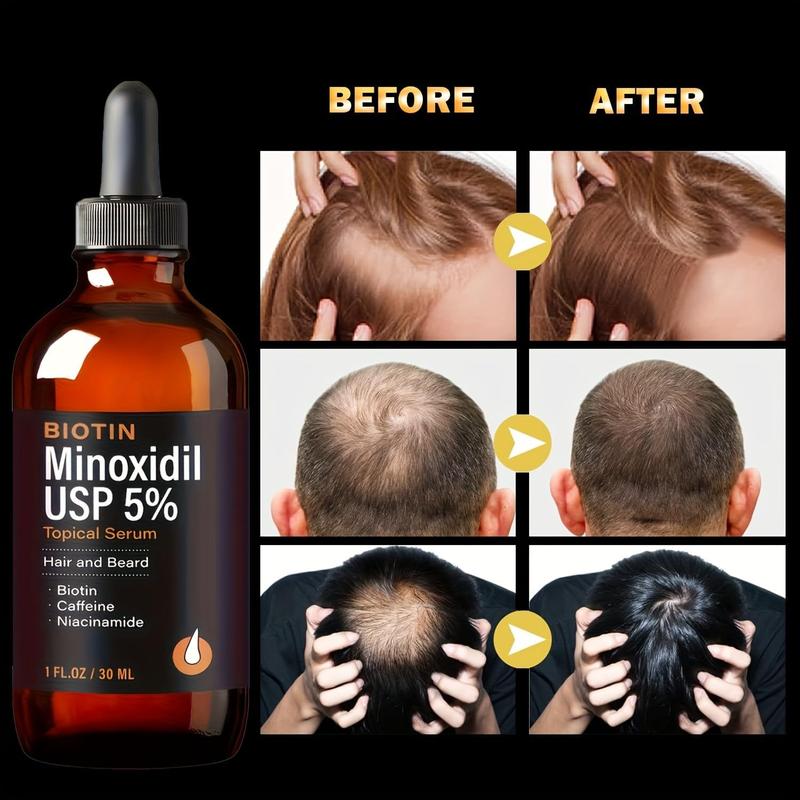 CVC 5% Minoxidil for Men&Women Hair Growth Serum Anti Hair Loss Treatment, Minoxidil for Men Beard Growth,5 Percent Hair Loss Treatments For Husband & Dad And Brother 30 ml, Orange, 2 pcs