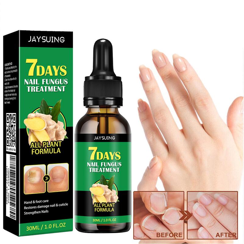 JAYSUING 7 Days Ginger Nail Oil, Nail Care Essence for Moisturizes and Thickens Nails -longer, Stronger and Brighter Nails