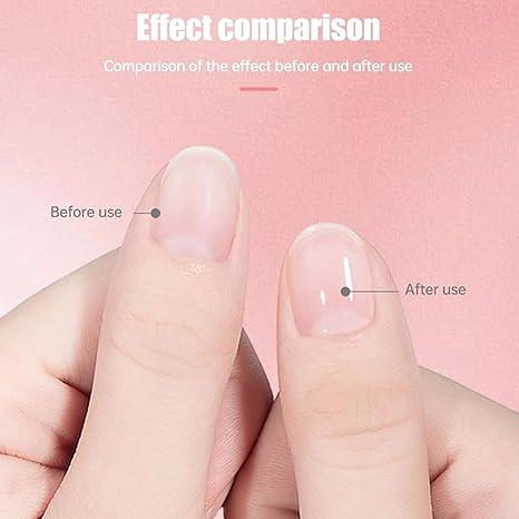 Brother Cosmetics Nail Growth Oil, Rejuvenation Nail Growth Oil,Nail Growth Oil for Strength and Moisture, Nail Growth and Strengthener Oil, Nail Strengthener for Thin Nails and Growth (2pcs)