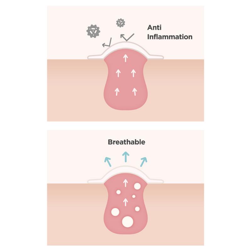 [ma:nyo Official Shop] Ac Rescue Ampoule Spot Patch Skincare Acne