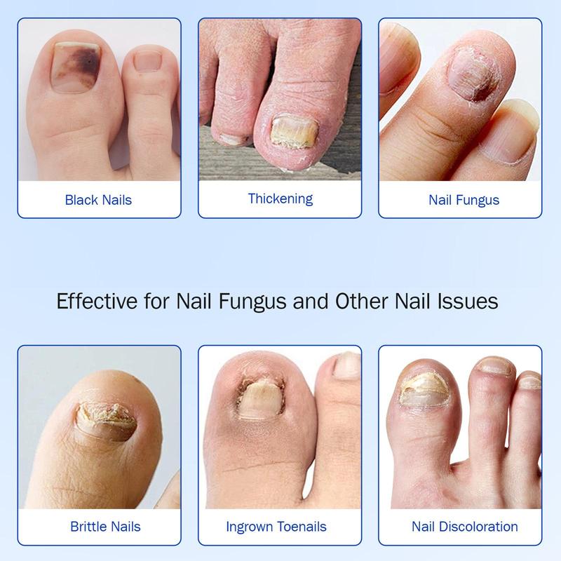 Fungal Nail Patches, 21pcs box Nail Health Care Patches, Nail Care Patches, Suitable for Solving Fungal Nails and Other Nail Problems