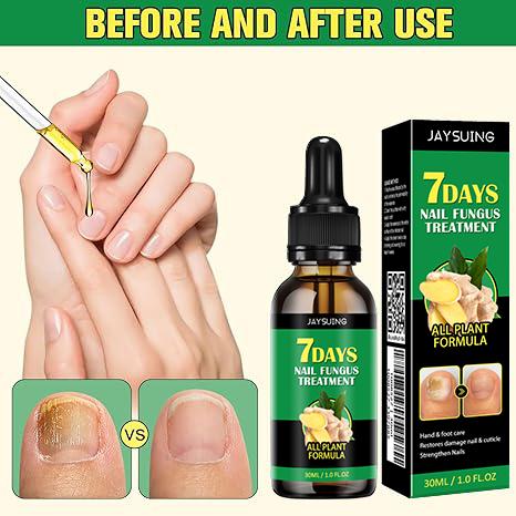 JAYSUING 7 Days Ginger Nail Oil, Nail Care Essence for Moisturizes and Thickens Nails -longer, Stronger and Brighter Nails